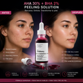 peeling solution, the ordinary: Renueva tu piel, revela su luminosidad